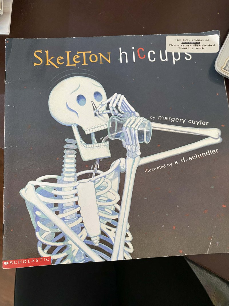 Skeleton Hiccups